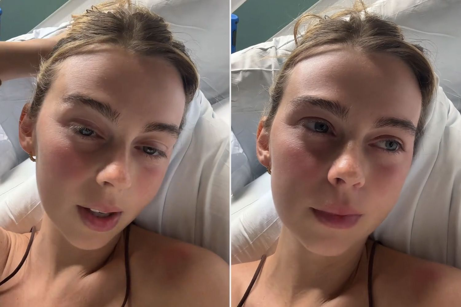 Sydney Towle Rushed to Hospital During Chemo — New Update Reveals What Doctors Found